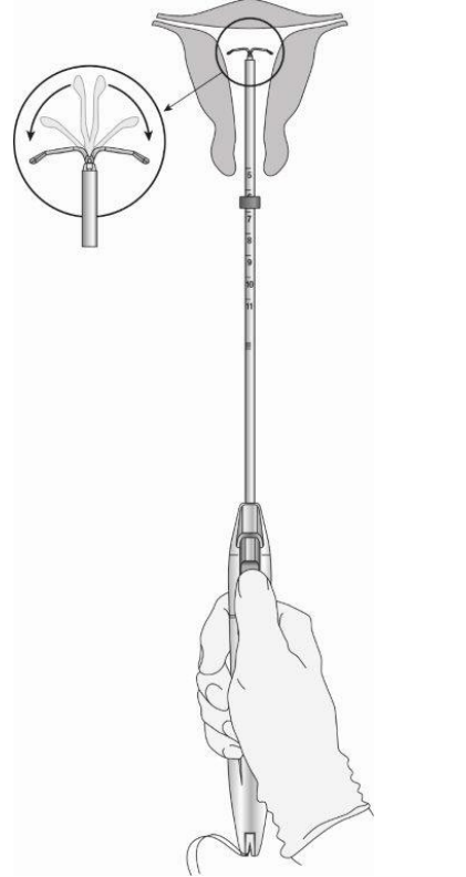 Донасерт Уно