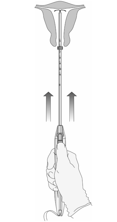 Донасерт Уно