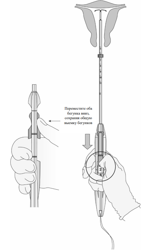 Донасерт Уно