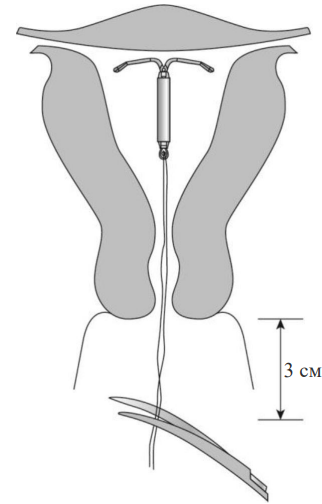 Донасерт Уно