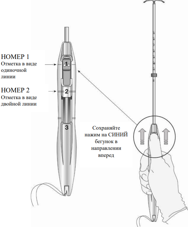 Донасерт Уно